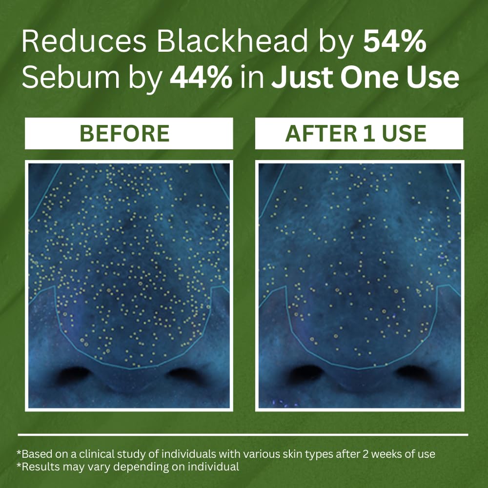 Viareline korean Holy Basil Bubble Deep Mask™