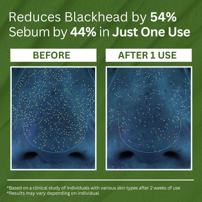 Viareline korean Holy Basil Bubble Deep Mask™